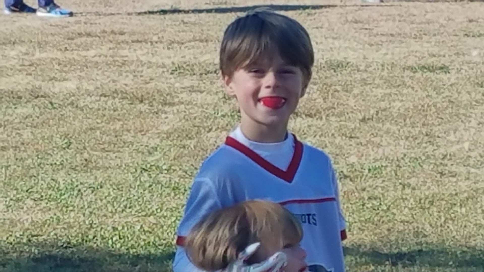 Mouth Guard in young boy